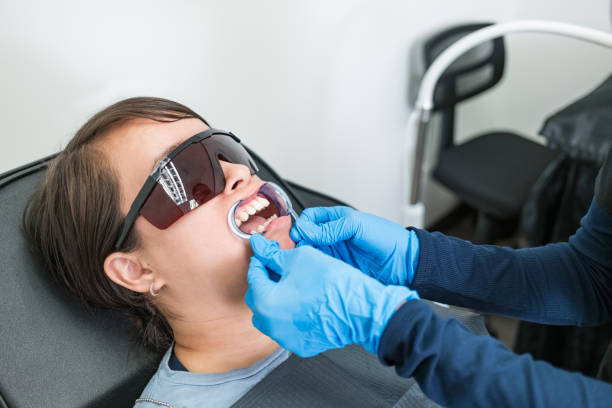 Best Knocked-Out Tooth (Avulsed Tooth) Treatment in Bay Park, NY