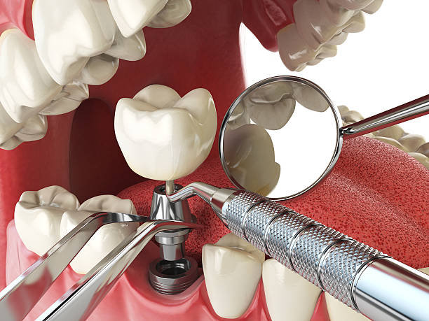Best Emergency Treatment for Oral Infections in Bay Park, NY